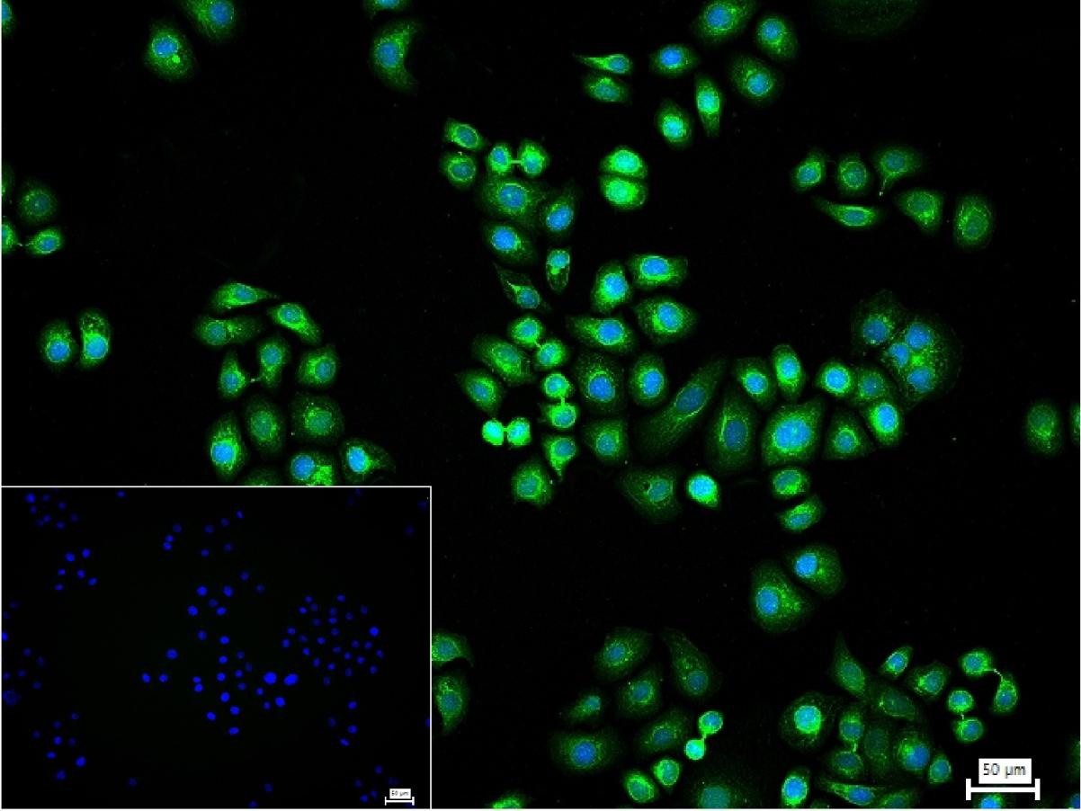蛋白二硫异构酶A6重组兔单抗-bsm-61392R