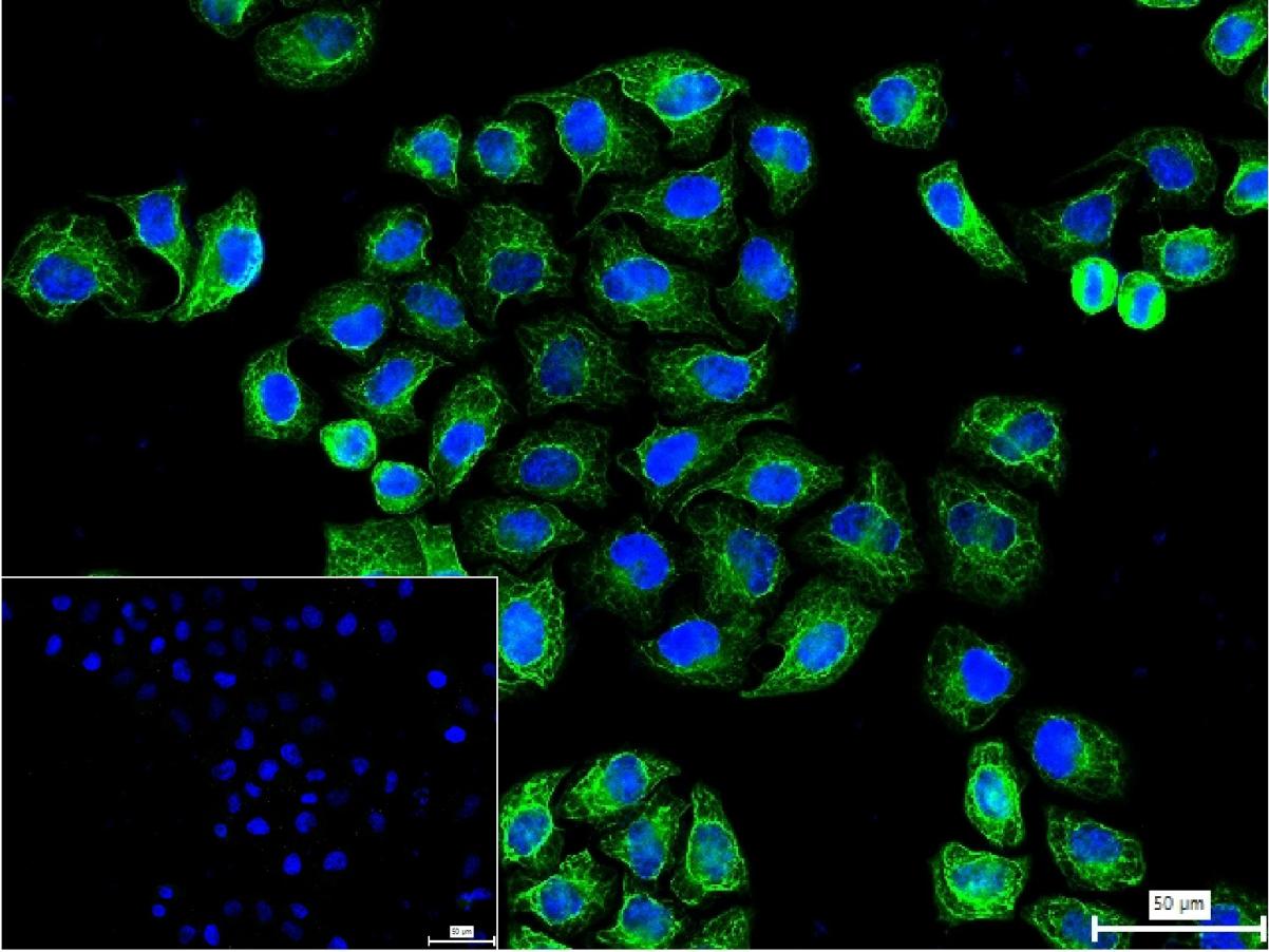 细胞角蛋白8重组兔单抗