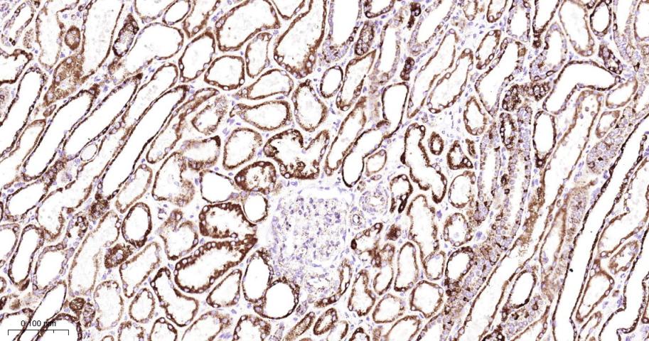 基质金属蛋白酶3重组兔单抗