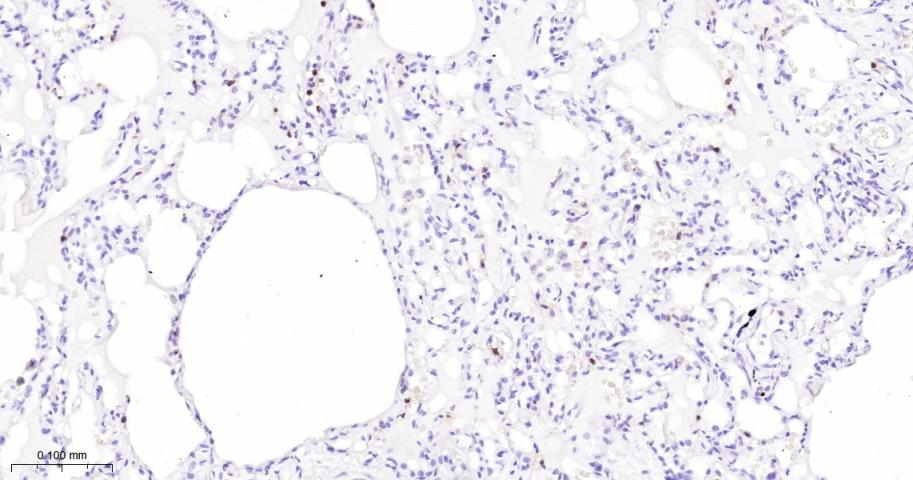 天青素/肝素结合蛋白单克隆抗体-bsm-41704M