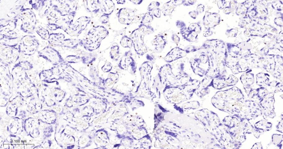 天青素/肝素结合蛋白单克隆抗体-bsm-41704M