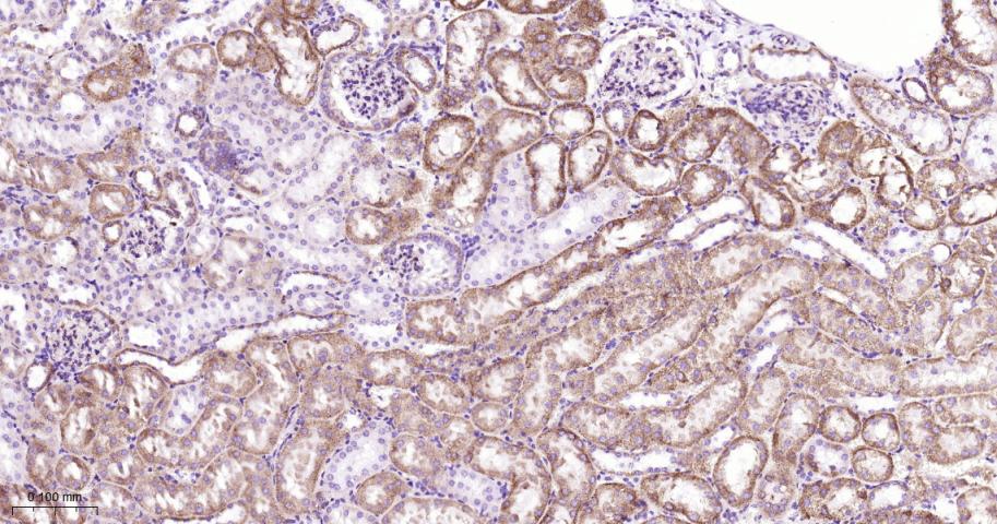 基质金属蛋白酶3重组兔单抗