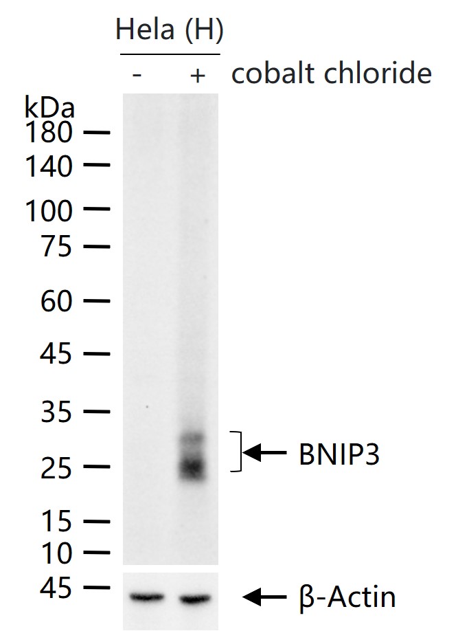 促凋亡调节蛋白BNIP3重组兔单抗