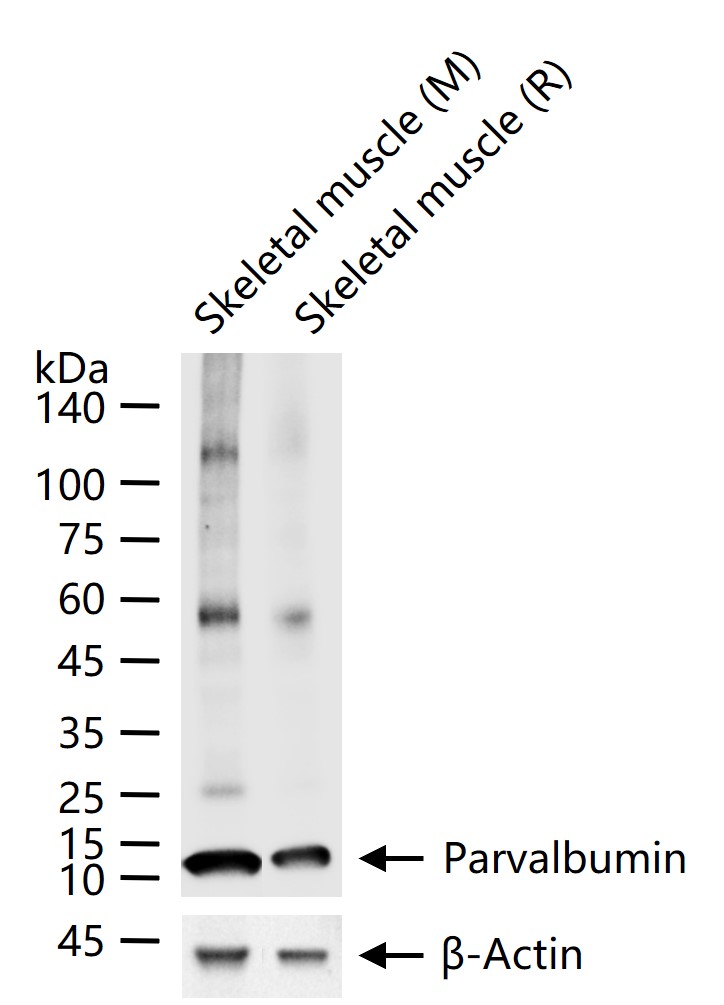 Parvalbumin Recombinant Rabbit mAb (一抗) - WB,IHC-P,IHC-F,IF,IP | Bioss