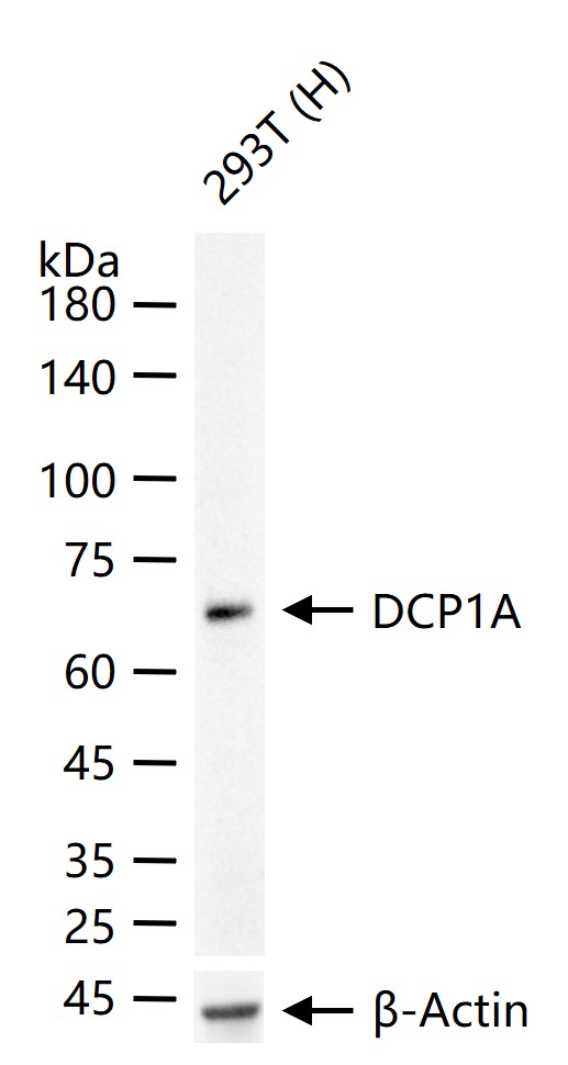 脱帽酶1A重组兔单抗