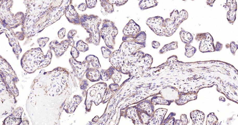 基质金属蛋白酶3重组兔单抗