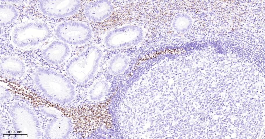 天青素/肝素结合蛋白单克隆抗体-bsm-41704M