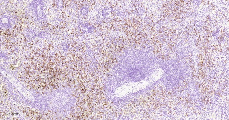 天青素/肝素结合蛋白单克隆抗体-bsm-41704M