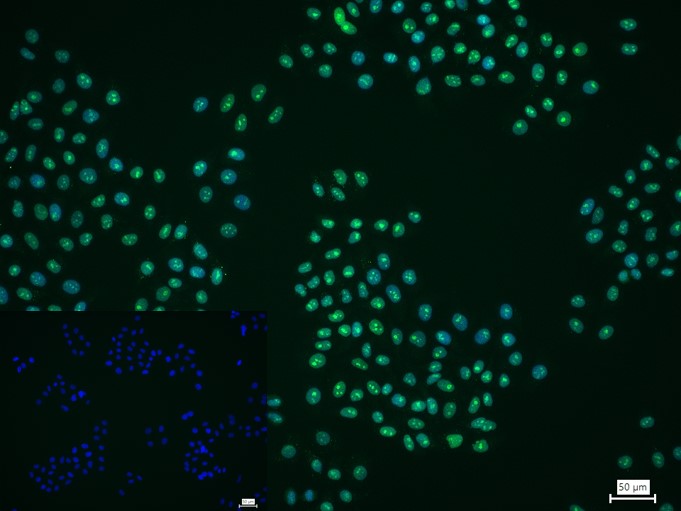 组蛋白去乙酰化酶8重组兔单抗