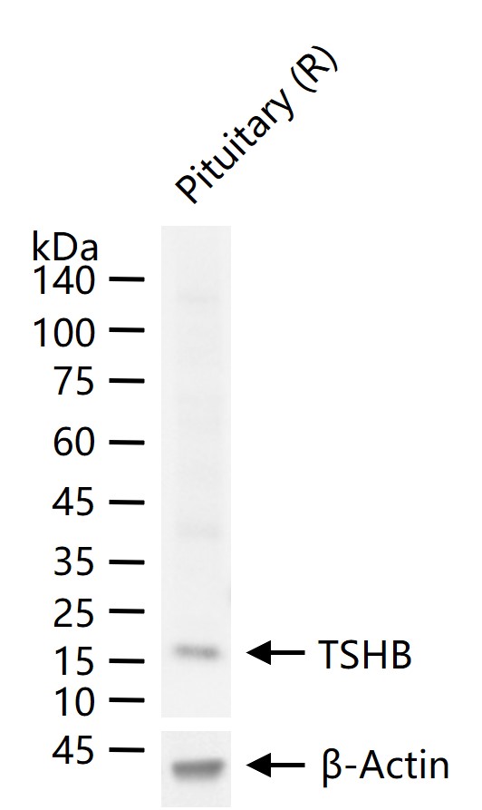 促甲状腺素β亚单位重组兔单抗