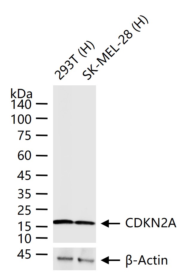 抑癌基因p16重组兔单抗