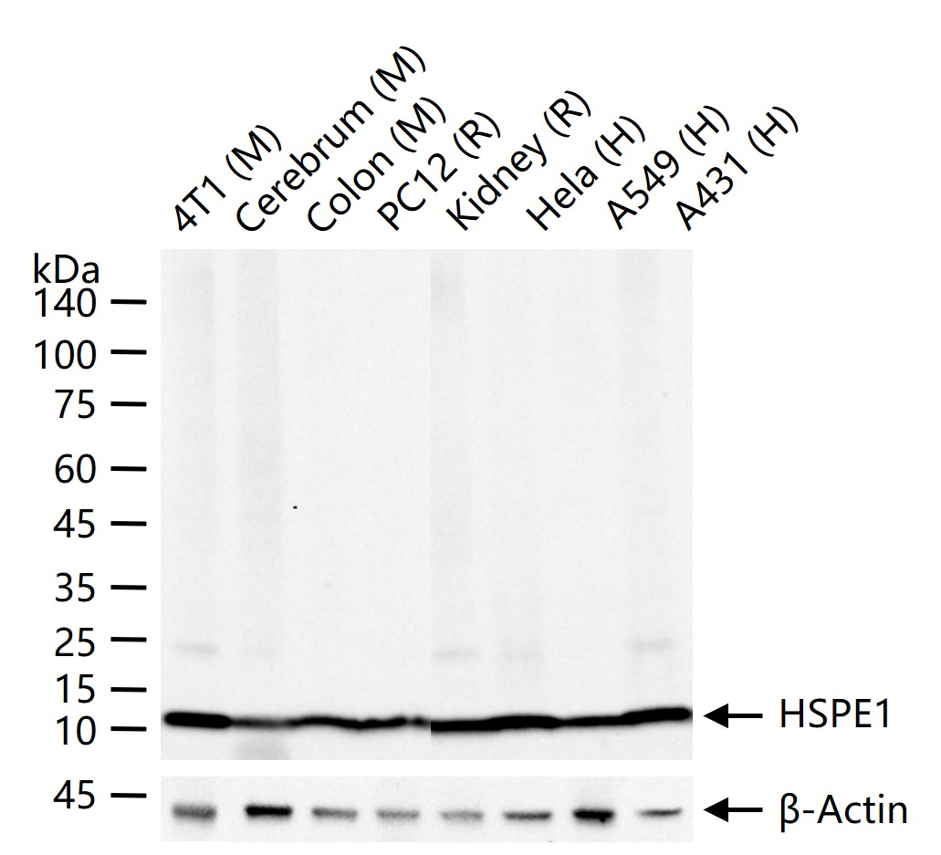 热休克蛋白10/HSPE1重组兔单抗