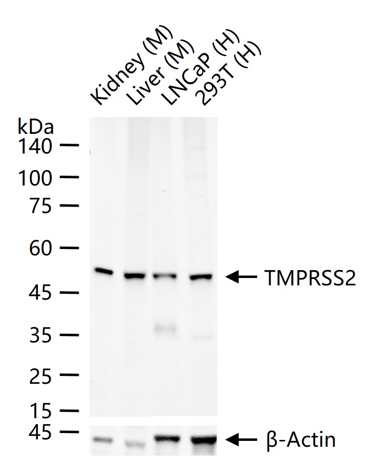 丝氨酸蛋白酶10重组兔单抗