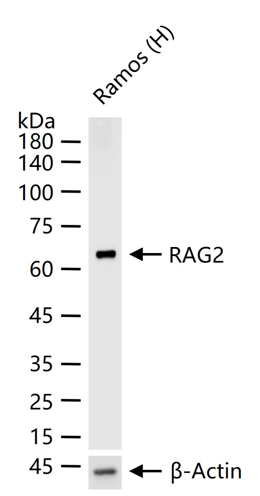 重组激活基因2蛋白重组兔单抗