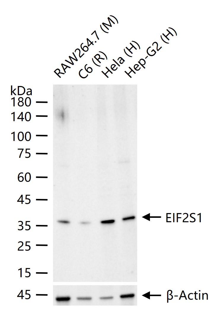 真核启动因子2α(eIFα2)兔单克隆抗体