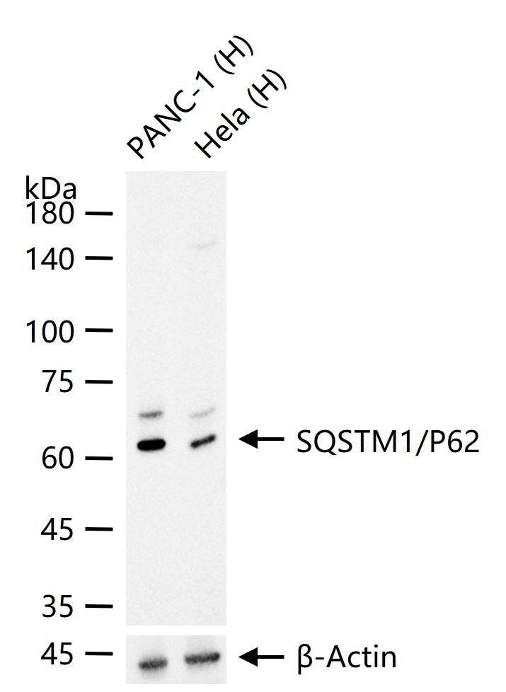 SQSTM1/P62单克隆抗体-bsm-51287M