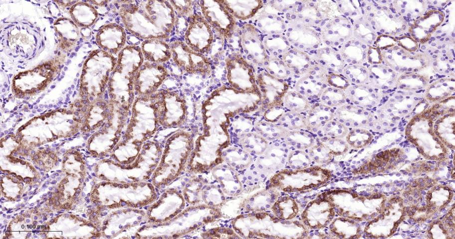 基质金属蛋白酶3重组兔单抗