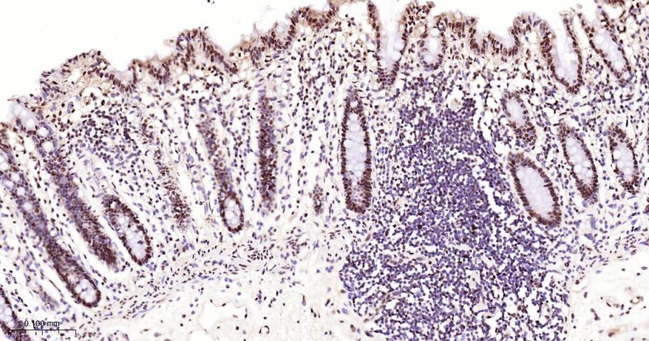 核基质蛋白3重组兔单抗