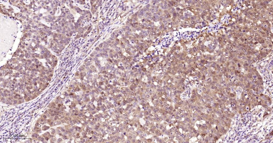 eIF4E结合蛋白重组兔单抗