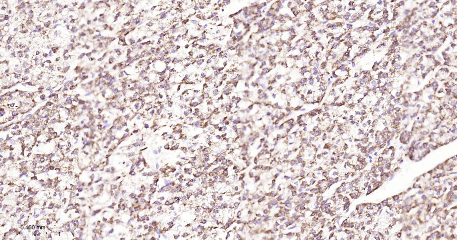 硫辛酰胺脱氢酶重组兔单抗