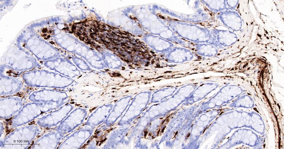S100钙结合蛋白A4重组兔单抗