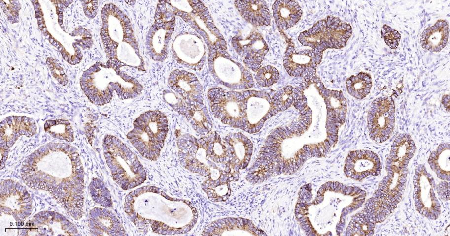 硫辛酰胺脱氢酶重组兔单抗