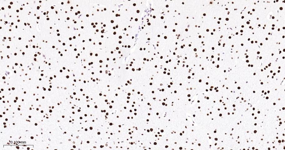 核基质蛋白3重组兔单抗