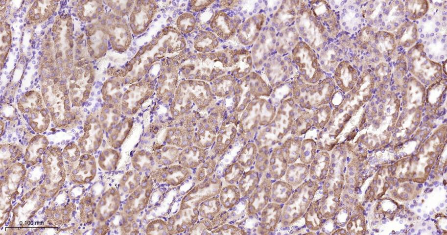 硫辛酰胺脱氢酶重组兔单抗