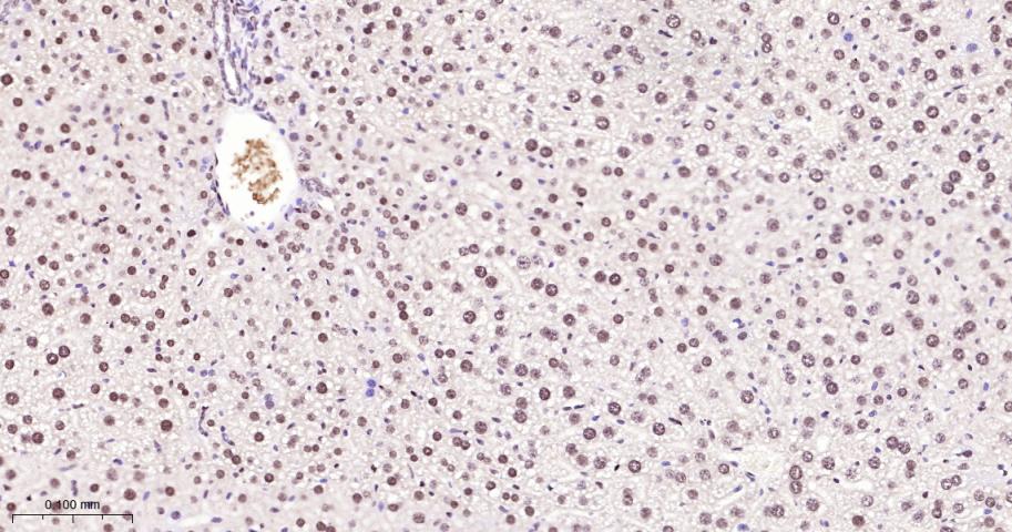 核基质蛋白3重组兔单抗