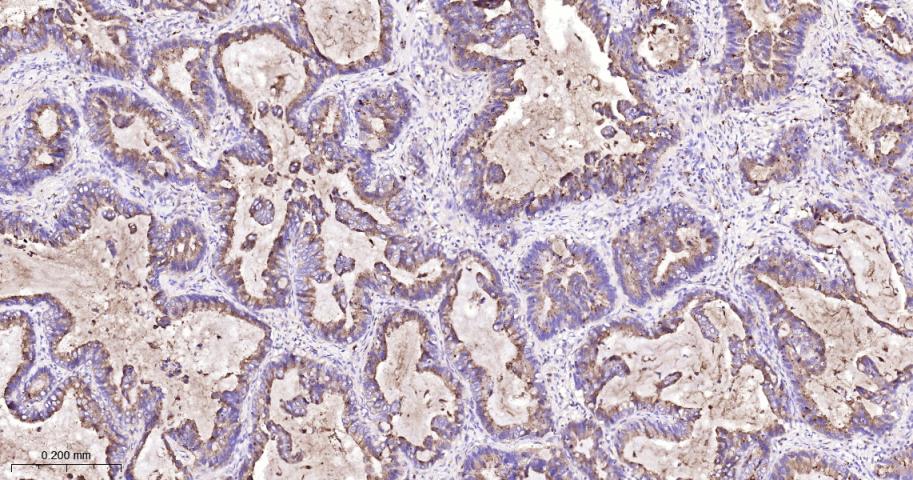 Rho GTP酶激活蛋白5重组兔单抗