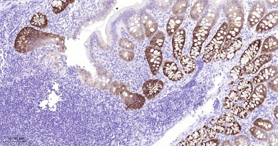 多巴胺/cAMP调节神经磷蛋白重组兔单抗