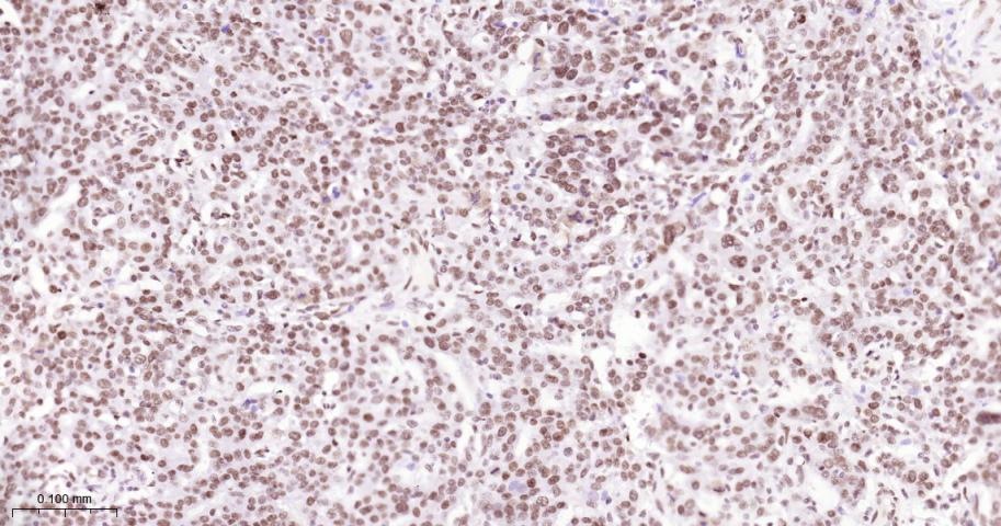 核基质蛋白3重组兔单抗