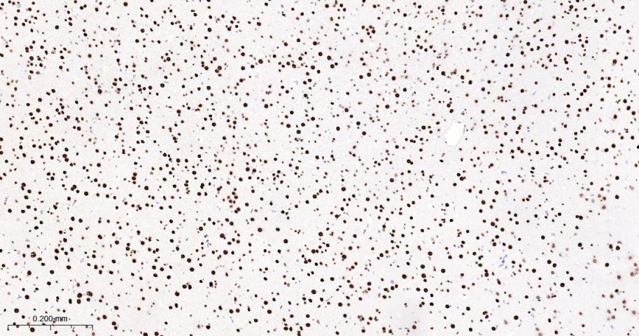 核基质蛋白3重组兔单抗