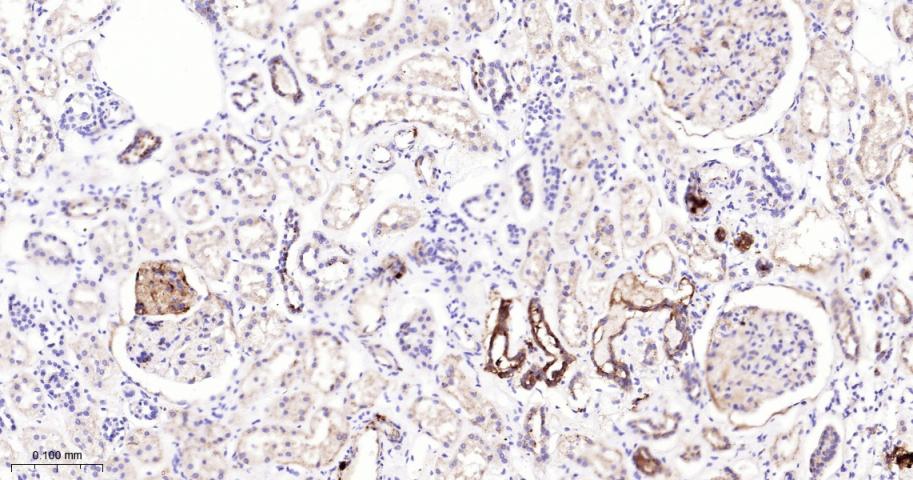 Rho GTP酶激活蛋白5重组兔单抗