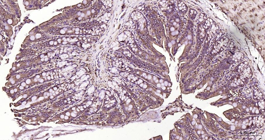 硫氧还蛋白结合蛋白2重组兔单抗