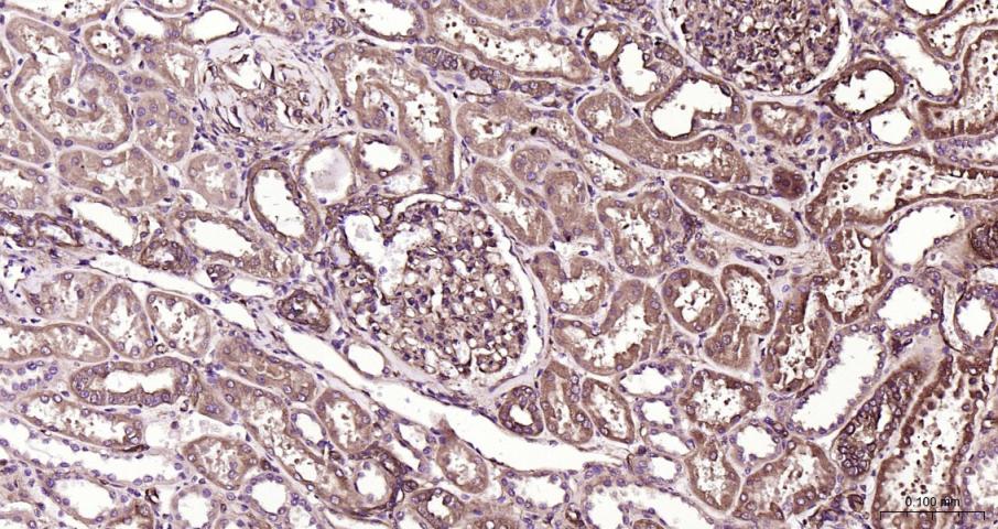 硫氧还蛋白结合蛋白2重组兔单抗