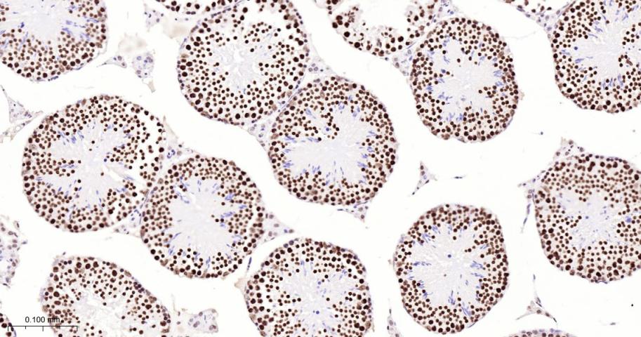 核基质蛋白3重组兔单抗