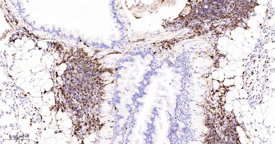 S100钙结合蛋白A4重组兔单抗