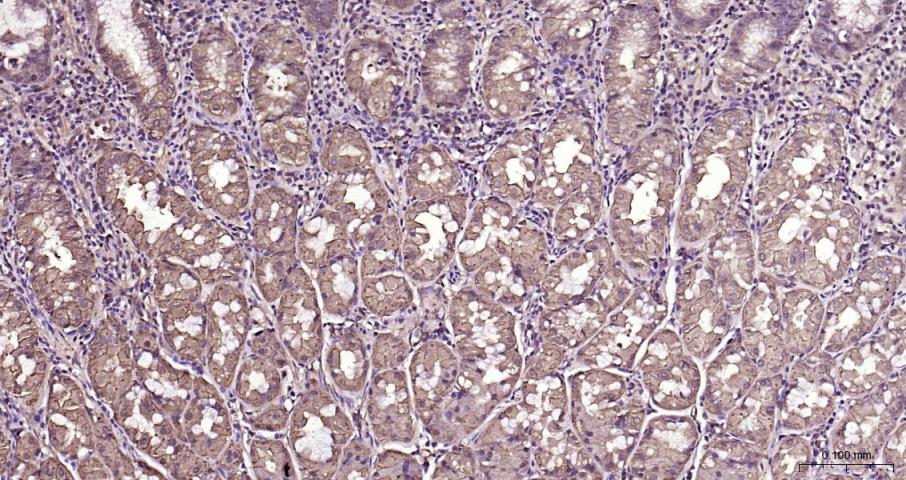 硫氧还蛋白结合蛋白2重组兔单抗