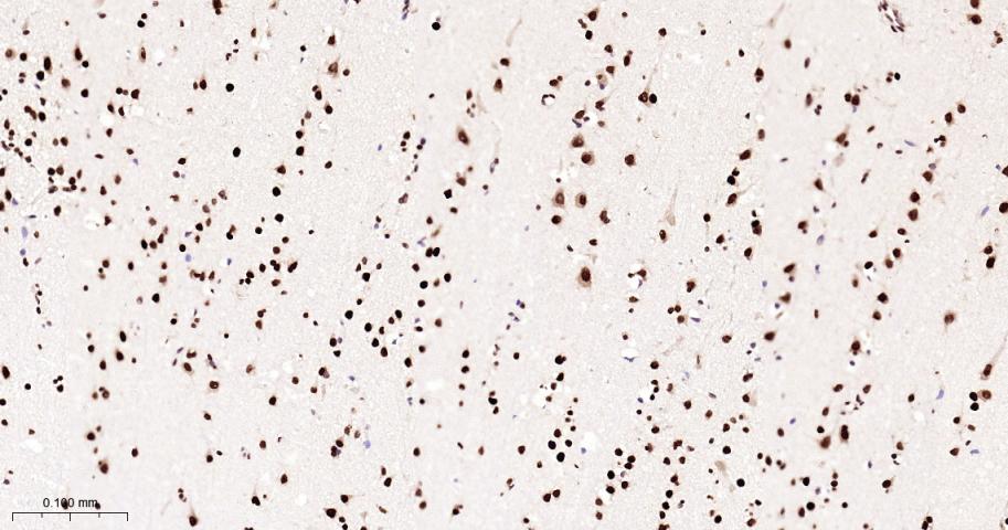 核基质蛋白3重组兔单抗