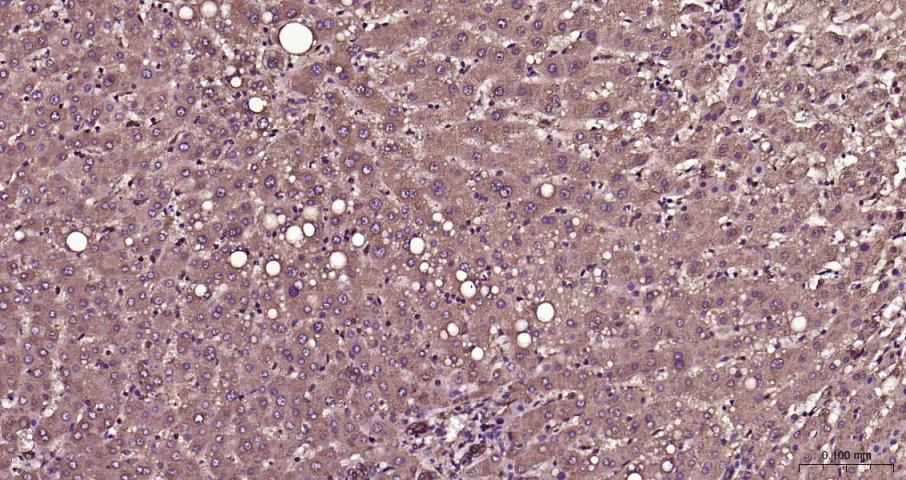 硫氧还蛋白结合蛋白2重组兔单抗