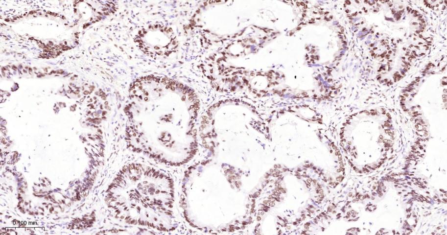 核基质蛋白3重组兔单抗