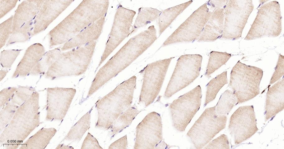 eIF4E结合蛋白重组兔单抗