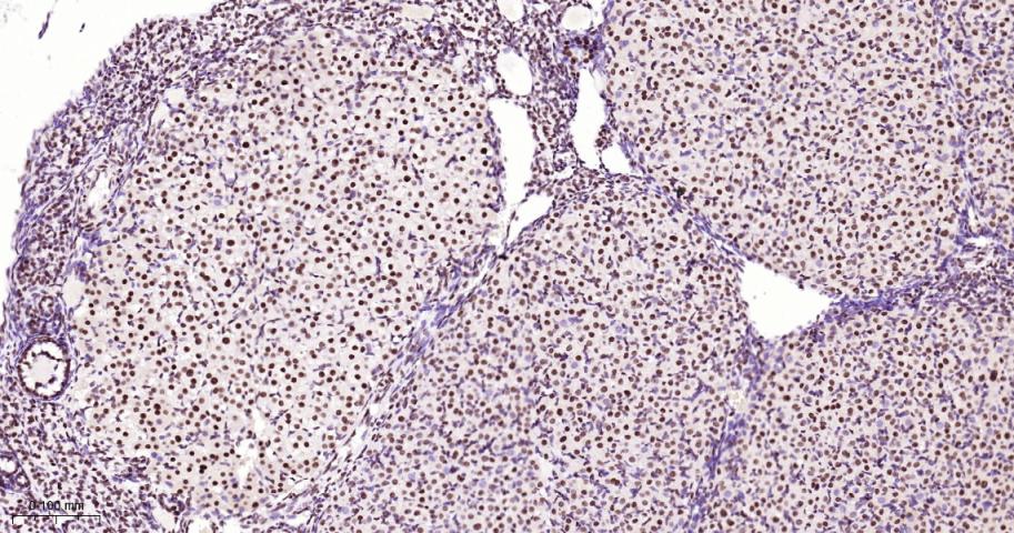 核基质蛋白3重组兔单抗