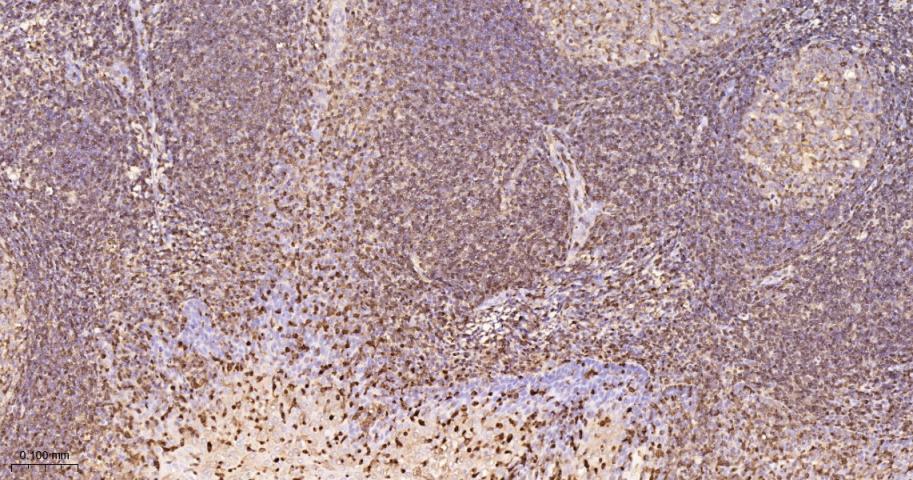 S100钙结合蛋白A4重组兔单抗