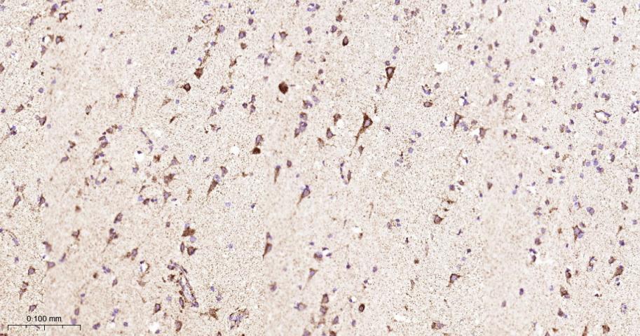 硫辛酰胺脱氢酶重组兔单抗
