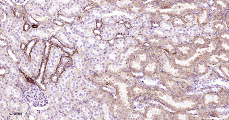 硫辛酰胺脱氢酶重组兔单抗