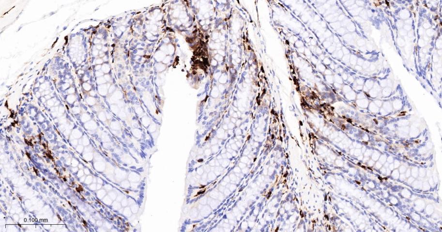 S100钙结合蛋白A4重组兔单抗