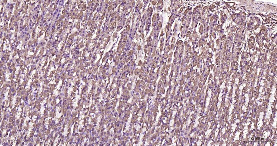 硫氧还蛋白结合蛋白2重组兔单抗