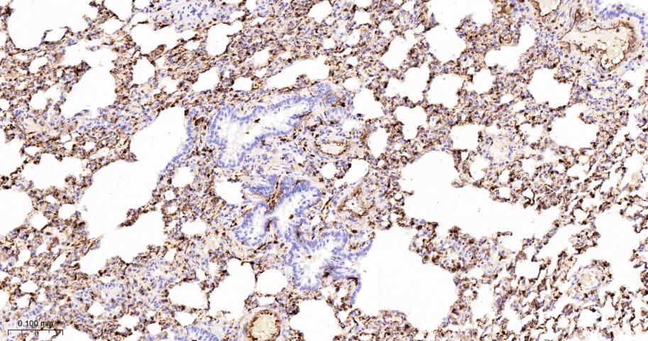 S100钙结合蛋白A4重组兔单抗